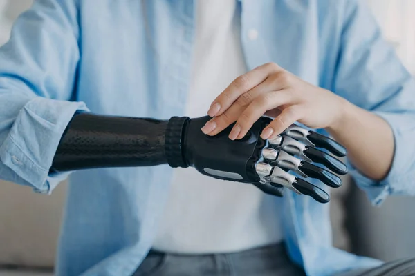 Cyber hand of female amputee. Disabled woman is changing settings of bionic arm. Electronic sensor hand has processor and buttons. High tech carbon robotic prosthesis. Medical technology and science.