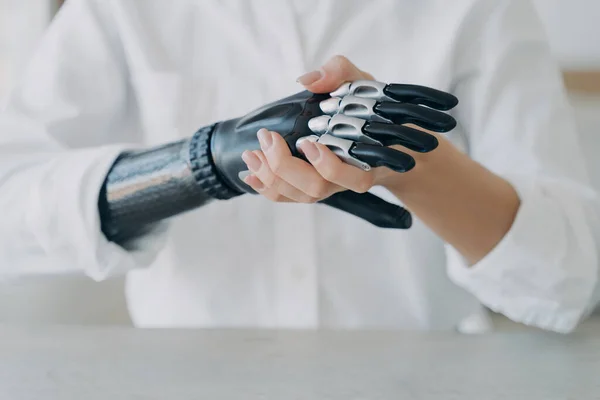 High tech carbon electronic hand. Disabled young woman is assembling bionic arm with hand. Steel cyber hand has software and buttons. Modern technology for wellbeing. Rehabilitation after trauma.
