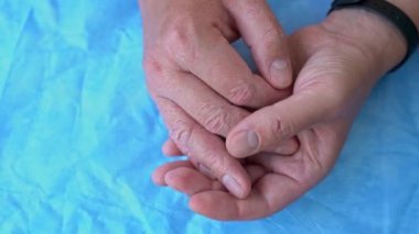 Erkek eli ve parmaklarında egzama dermatiti var. Mavi arka planda deri soyma ve insan eli desquamasyonu. Ellerinde güçlü alerjik diyatez var. Kabarcıkları olan kırmızı, çatlak bir cilt. Tıbbi video