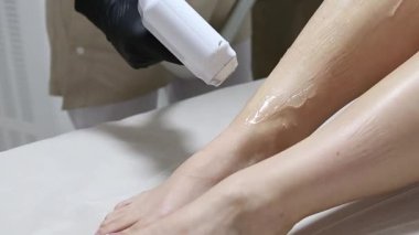 Bacaklarda lazer tüyü alındı. Kadın güzellik tedavisi görüyor, epilasyon. Doktor lazer aygıtı kullanıyor..