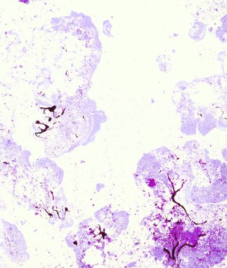 Tükenmez kalem mürekkebi ile kağıt bilye tekniği tarafından pigmentasyon malzemesi olarak üretilen rastgele desen