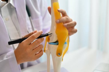 Kadın doktor, ortopedistler online danışmanlık sırasında diz eklem modeli gösteriyor. Teletıp ve sağlık hizmeti kavramı.