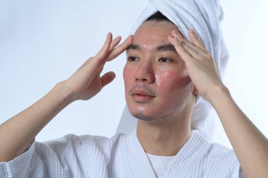 Adam CO2 lazer tedavisinden sonra yüzüne nemlendirici sürüyor. Cilt bakımı ve kozmetik prosedürleri kavramı.