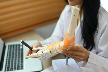 Profesyonel ortopedi doktoru hastaya tedaviyi açıklıyor. Ayak ve ayak kemiklerinin modelini gösteriyor..