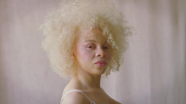 Στούντιο Πλάνο Της Αυτοπεποίθηση Και Θετική Νεαρή Γυναίκα Albino Φορώντας — Αρχείο Βίντεο