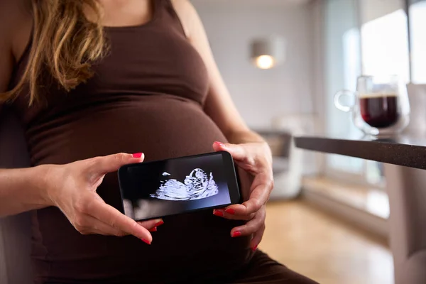 Närbild Gravida Kvinna Som Håller Mobiltelefon Med Ultraljud Scan Baby — Stockfoto