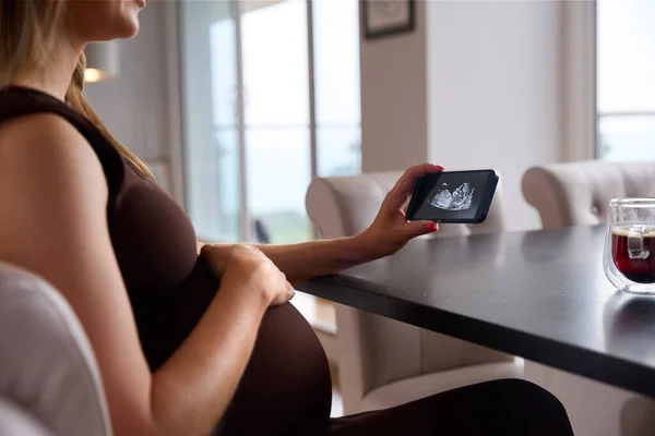 赤ちゃんの超音波スキャンで電話を見て妊娠中の女性のクローズアップ — ストック写真
