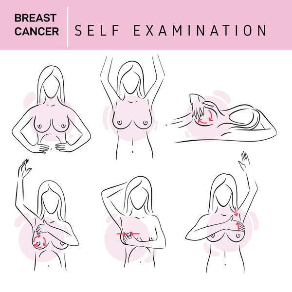 Breast cancer, medical infographic. Women's health set. Woman examining breasts. Prevention of breast cancer. Self-examination. Vector healthcare poster or banner template.