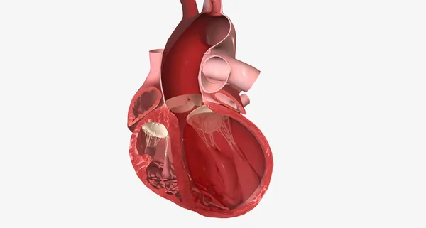 Congestive heart failure is a cardiovascular disorder that occurs when your heart cannot pump enough blood to supply the body.3D rendering