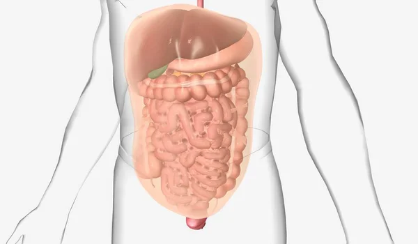 Abdominal adhesions are bands fibrous tissue formed after surgery between the abdominal organs and surrounding tissues The lymphatic system is a network of organs, tissues, vessels and nodes that filter the lymph throughout the body. 3D rendering