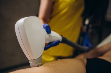 Vücut Bakımı. Bacaklar Lazer Epilasyon. Genç Kadının Bacağının Saçlarını Kaldıran Güzellik Uzmanı. Kozmetik Güzellik Kliniğinde Lazer Epilasyon Tedavisi. Tüysüz Pürüzsüz Ve Yumuşak Cilt. Sağlık ve Güzellik Kavramı.