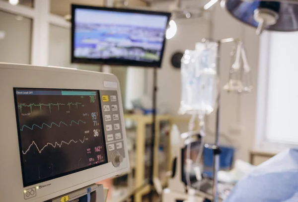 Электрокардиограмма Стационарной Хирургии Операционная Скорой Помощи Показывает Частоту Сердечных Сокращений — стоковое фото