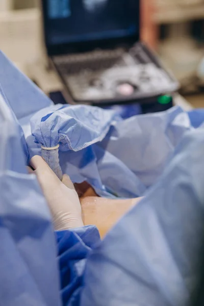 Doktor Ayak Dikişi Perkütan Transluminal Anjiyoplasti Vasküler Bypass Kan Damarı — Stok fotoğraf