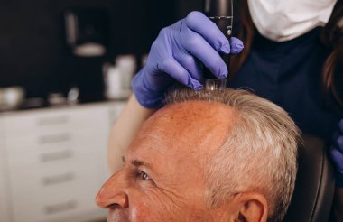 Yaşlı bir adam saç nakli kliniğinde muayene ediliyor..