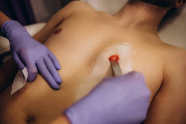 Evde balmumu epilasyon kullanan kıllı bir adamın göğsünü kapatın. Vücut Kılları Çıkarma Cilalama Sıcaklığı. Yüksek kalite fotoğraf