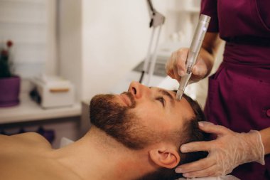 Erkek kozmetolojisi. Kozmetik kliniğindeki adamın dermastamp fraksiyonel mezoterapi tedavisi. Yüksek kalite fotoğraf