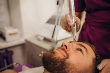 Erkek kozmetolojisi. Kozmetik kliniğindeki adamın dermastamp fraksiyonel mezoterapi tedavisi. Yüksek kalite fotoğraf