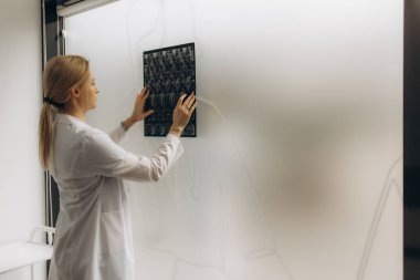 Kadın doktor hastanedeki hastanın anatomi ve fizyoloji röntgenlerini kontrol ediyor. Doktor bilim adamı röntgen filminde viral enfeksiyonu inceliyor.