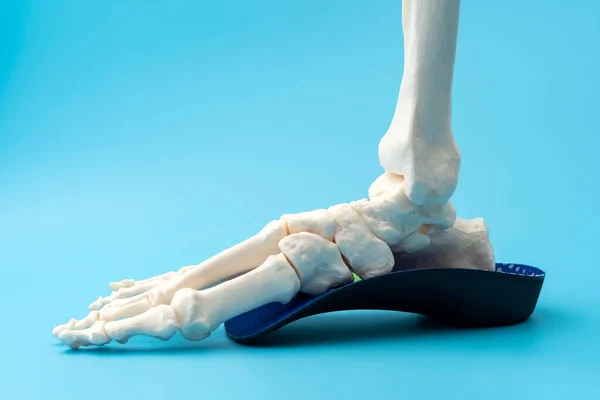 Anatomical model of the bones of the human foot wearing an orthopedic insole concept for Physical therapy for leg injury, Skeletal anatomy model benefits and Joint pain relief techniques