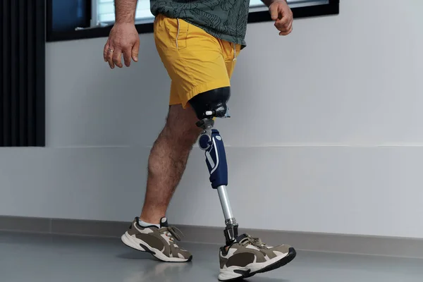 Αγνώριστο Αρσενικό Κίτρινο Χρώμα Σορτς Φορώντας Προσθετικό Πόδι Περπατώντας Φωτεινό — Φωτογραφία Αρχείου