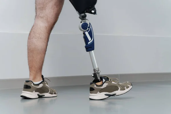 Unrecognisable male wearing prosthetic leg walking in luminous spacious corridor