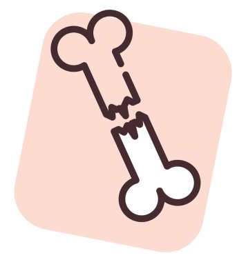 Kırık kemik, illüstrasyon veya simge, beyaz arkaplanda.