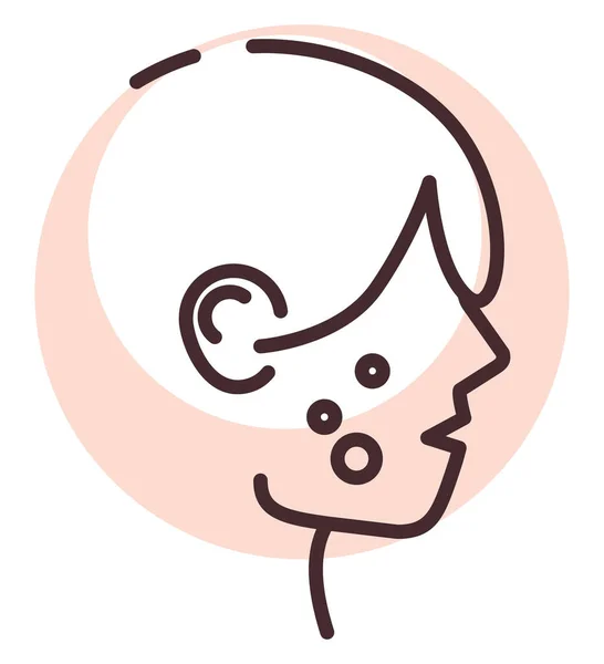 Face allergy, illustration or icon, on white background.