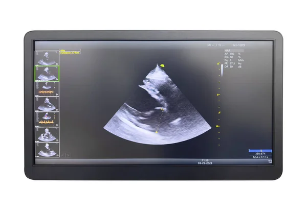 Utrasound Image Monitor Close Ultrasound Scan Examination Display Screening Ultrasonography — Stock Photo, Image