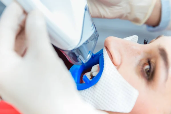 Zbliżenie Dentysty Pomocą Lampy Led Procedury Wybielania Zębów Dla Pacjenta — Zdjęcie stockowe