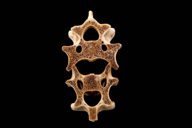 Siyah arkaplanda kemikler, fotoğrafa yakın çekim