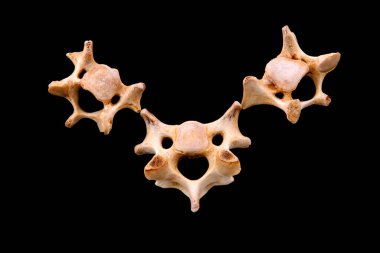 Siyah arkaplanda kemikler, fotoğrafa yakın çekim