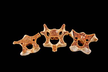 Siyah arkaplanda kemikler, fotoğrafa yakın çekim