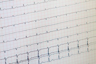 Fotoğrafın elektrokardiyogramı (ecg) yakın plan