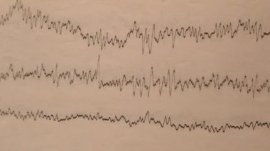 Eski bir kağıttaki depremin sismograf kaydı. Beynin elektriksel aktivitesindeki hastaların EEG 'si