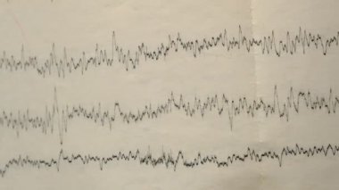 Eski bir kağıttaki depremin sismograf kaydı. Beynin elektriksel aktivitesindeki hastaların EEG 'si