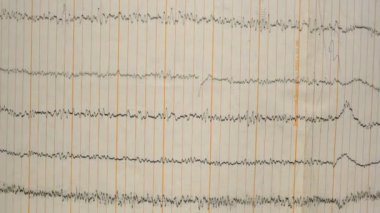 Eski bir kağıttaki depremin sismograf kaydı. Beynin elektriksel aktivitesindeki hastaların EEG 'si