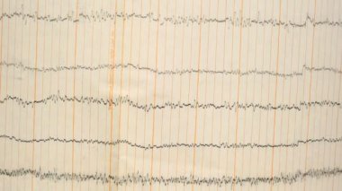 Eski bir kağıttaki depremin sismograf kaydı. Beynin elektriksel aktivitesindeki hastaların EEG 'si