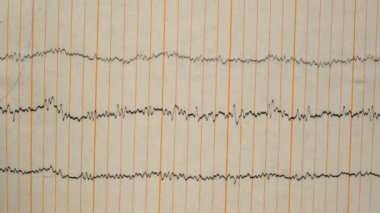 Eski bir kağıttaki depremin sismograf kaydı. Beynin elektriksel aktivitesindeki hastaların EEG 'si