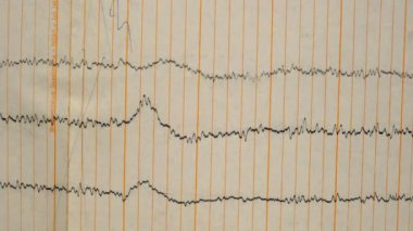 Eski bir kağıttaki depremin sismograf kaydı. Beynin elektriksel aktivitesindeki hastaların EEG 'si