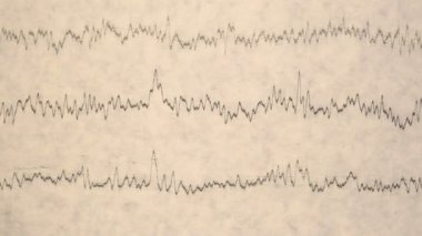 Eski bir kağıttaki depremin sismograf kaydı. Beynin elektriksel aktivitesindeki hastaların EEG 'si
