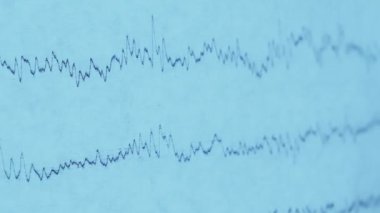 Eski kağıt üzerinde bir depremin sismografı, hastaların EEG 'si beynin elektriksel aktivitesindeki sorunlar.