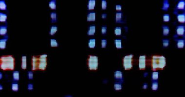 Ekran Arızaları - Dijital ve Analog Televizyon ya da İzleyici Müdahalesi