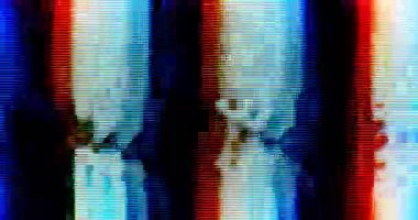 Ekran Arızaları - Dijital ve Analog Televizyon ya da İzleyici Müdahalesi