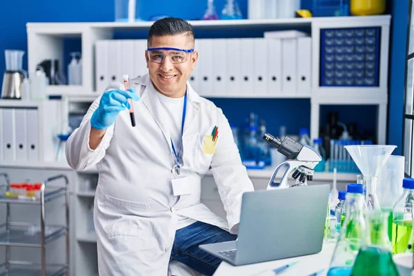 Laboratuvarda Kan Testi Tüpü Tutan Dizüstü Bilgisayar Kullanan Genç Latin — Stok fotoğraf