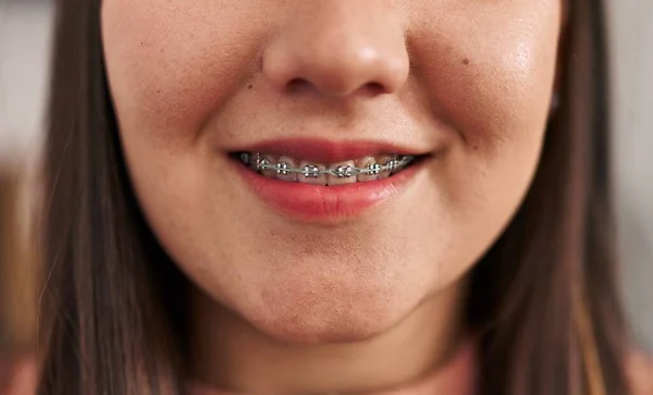 Young Hispanic Woman Wearing Brackets Smiling Confident Office — 스톡 사진