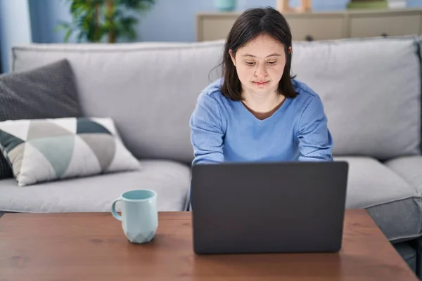 使用笔记本电脑 坐在沙发上喝咖啡的患有下行综合症的年轻女性 — 图库照片