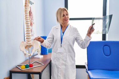 Middle age blonde woman wearing physiotherapist uniform holding xray at physiotherapy clinic