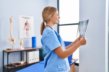 Young hispanic woman physiotherapist holding xray at rehab clinic