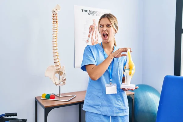 Young Blonde Orthopedic Woman Holding Anatomical Model Knee Joint Angry — Stock Photo, Image