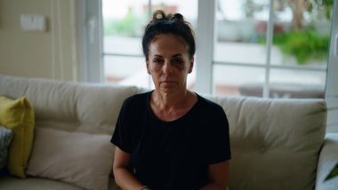 Orta yaşlı İspanyol kadın aile içi şiddet yüzünden acı çekiyor. Gözlerinde morluklar var.